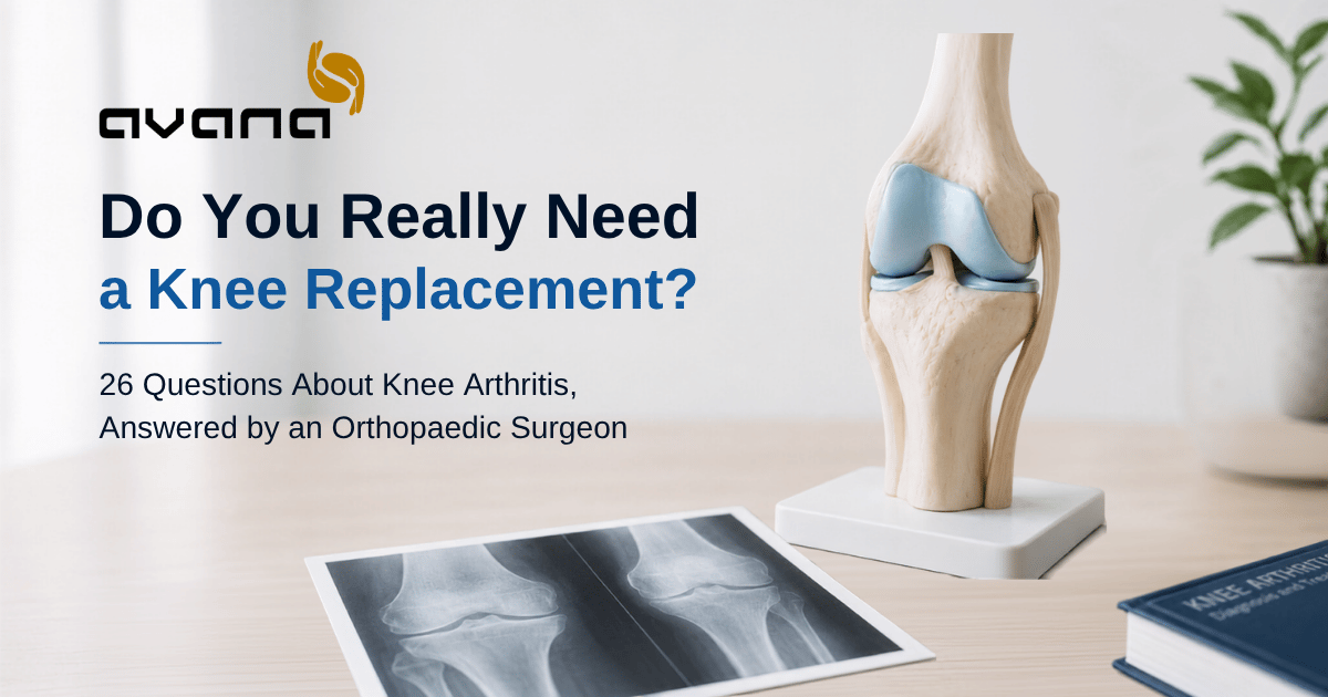 Do You Really Need a Knee Replacement? 26 Questions About Knee Arthritis, Answered