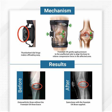Freestyle OA knee Brace offloading mechanism